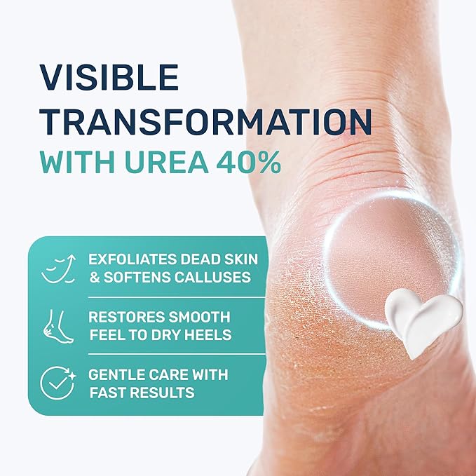 Urea Cream 40 Percent for Feet Maximum Strength, Callus Remover Foot Cream, Dry Cracked Heels Exfoliating Lotion with Salicylic Acid, Ceramides, Tea Tree Oil – Women and Men, 4.3 oz