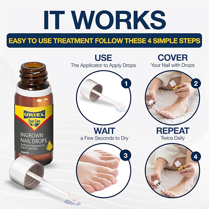 URIEL UPGRADED Ingrown Toenail Treatment, Ingrown Toenail Removal Kit, Ingrown Toenail Corrector, Ingrown Nail Kit Ingrown Toenail Tool 11 ml