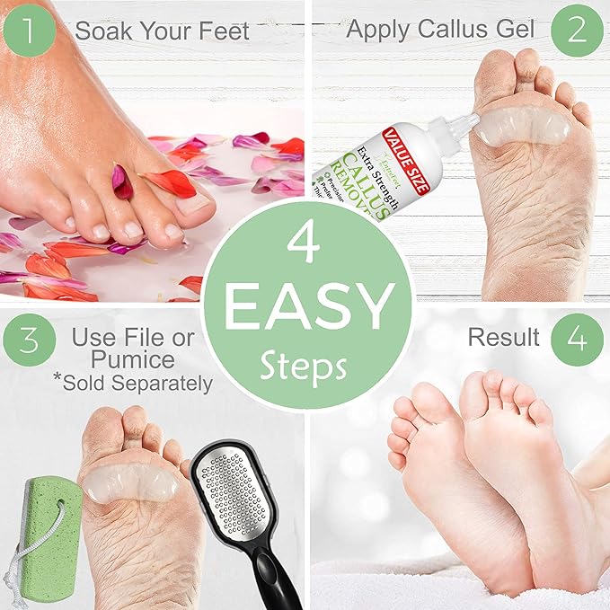 Dr. Entre's 16oz Callus Remover Gel: Extra Strength Value Size, Callus Remover for Feet, Pedicure Tools Supplies, Dead Skin Remover, Foot Care