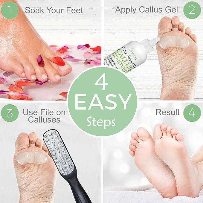 Callus Remover Gel & Double-Sided Foot File: 8 oz Extra Strength Callus Remover for Feet, Foot Callus Remover Care, Pedicure Tools Supplies, Spa Kit, Dead Skin Scrubber