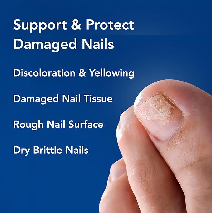Nighttime Renewal Fungal Nail Patches - 36 Pack - Overnight Repair for Nail Fungus Damage, 8-Hour Treatment Restores Healthy Appearance