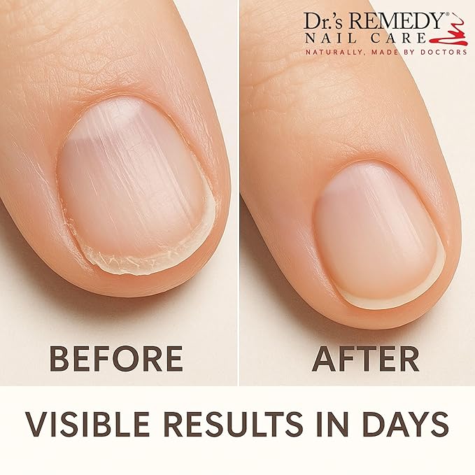 Dr’s Remedy Nail Polish Treatment, Non Toxic and Organic All Natural Enriched Nail Strengthener - Nourish Nail Serum