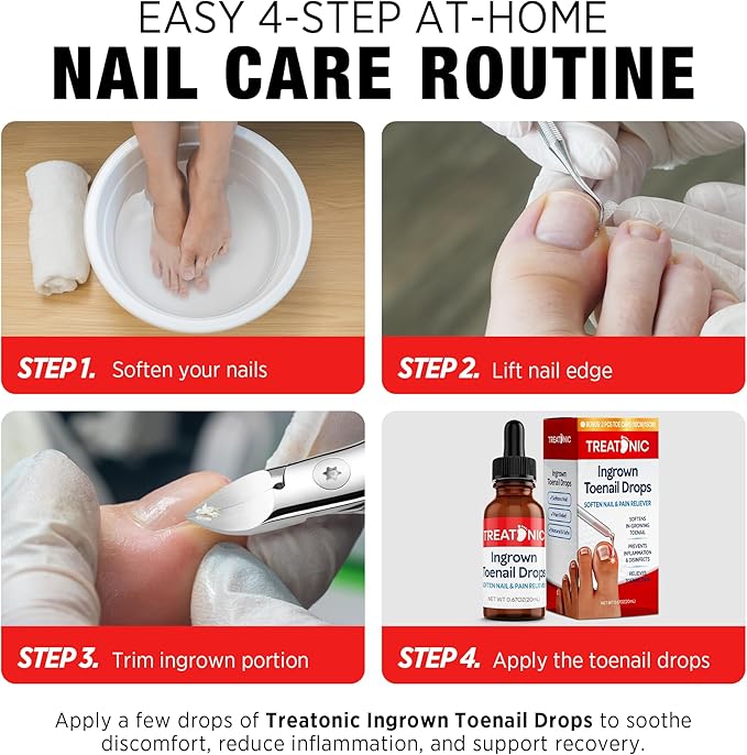 Treatonic Ingrown Toenail Clipper Removal Kit - Toenail Clippers for Thick, Fungal-Damaged, Curved Nails with Lifter & File, Long-Handle Pedicure Tools for Men, Women & Seniors