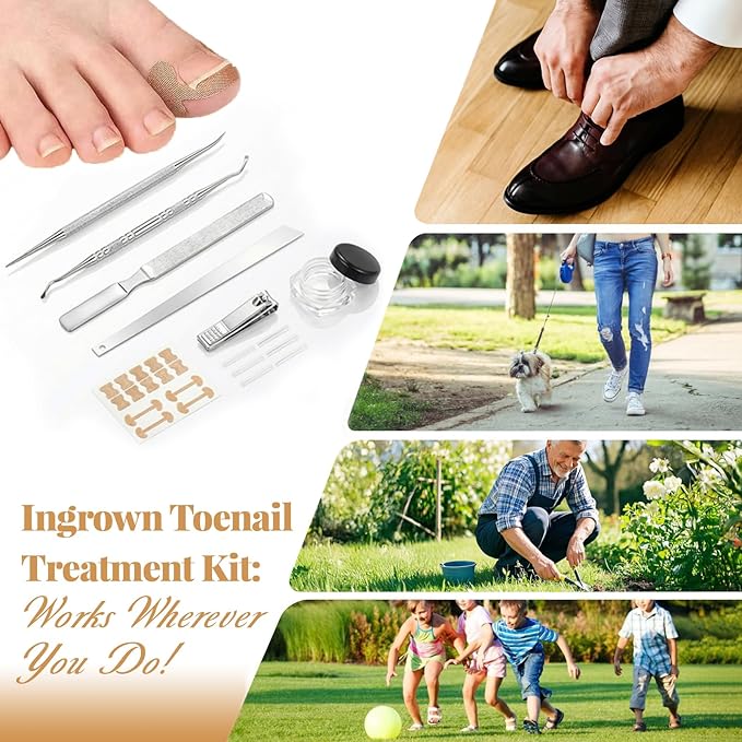 Ingrown Toenail Removal & Corrector Kit for Fast Pain Relief - Professional Ingrown Toenail Treatment Kit with Curved Strips, Breathable Patches & Pedicure Tools, Prevention & Healthy Nail Growth