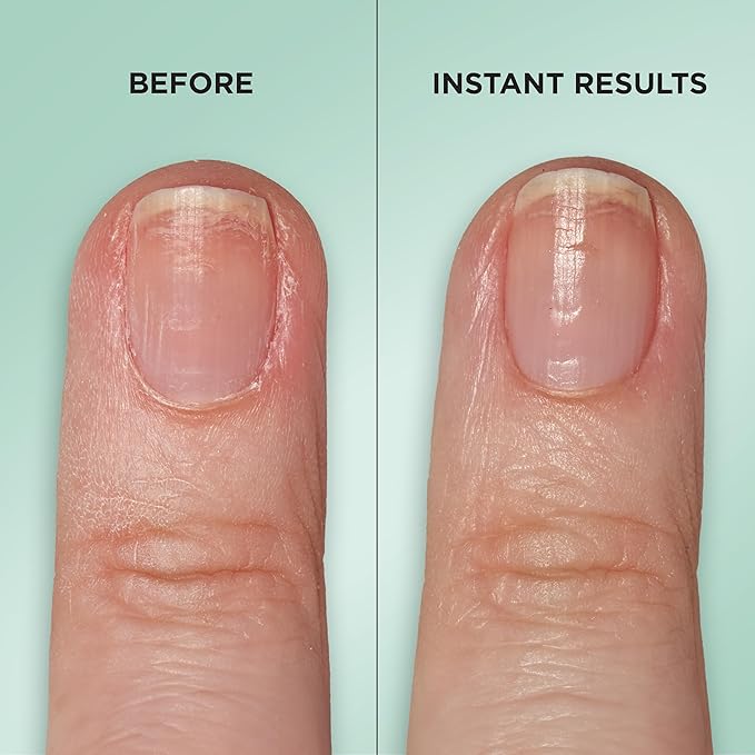 Sally Hansen Gel Rehab Nail Treatment Pen | Repair, Hydrate & Renew | Strengthens and Restores Damaged Nails | Keratin & Vitamin Complex | Easy, Mess-Free Nail Care on the Go