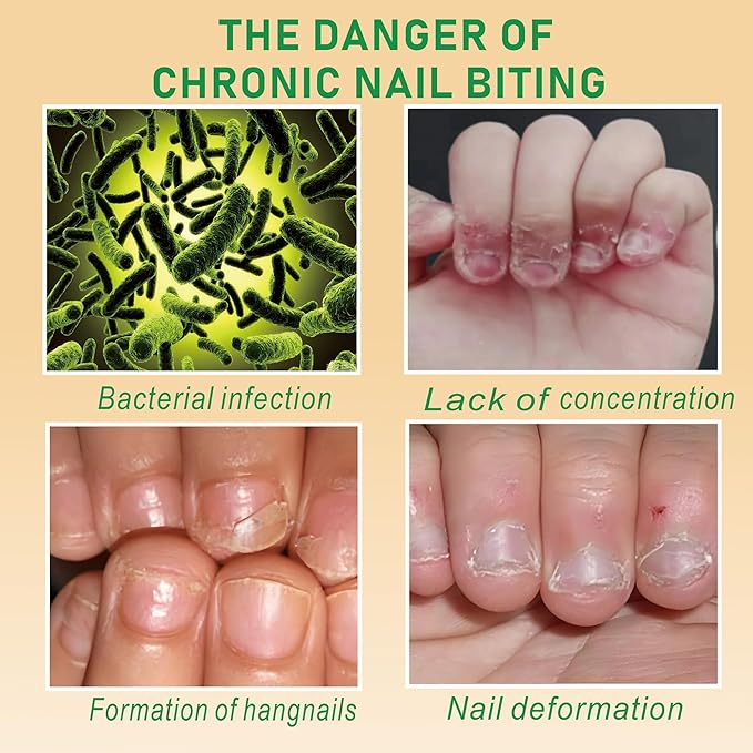 Upgraded Nail Biting Treatment for Kids & Adults ultra bitter for stubborn habits, Fast Drying, Stops Thumb Sucking, Helps Repair & Strengthen Damaged Nails, 0.5 fl oz (15ml)