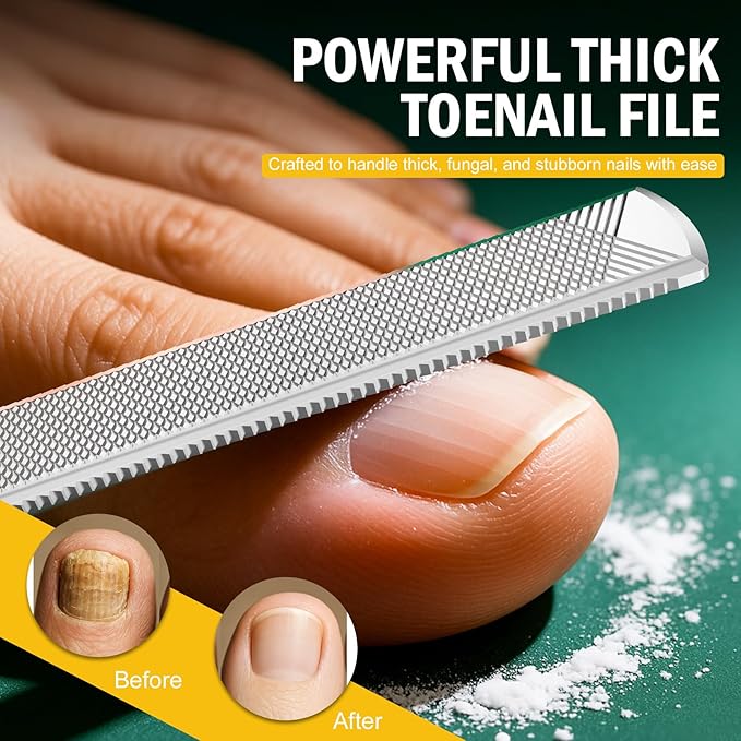 FVION Toenail File for Thick Nails and Toenail Lifter, 2pcs Stainless Steel Nail File and Ingrown Relief Set, Heavy Duty Metal Emery Board for Seniors, Men & Women Pedicure Tool (Black)