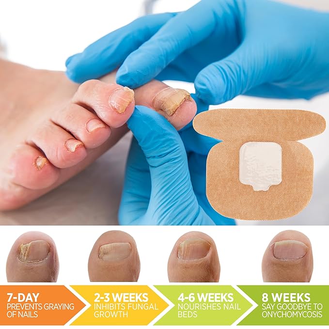Large Nail Patches Extra Strength: 21 PCS Nighttime Hydrogel Patches for Overnight Repair - Visible Results in 8 Hours - Toenail Treatment Extra Strength