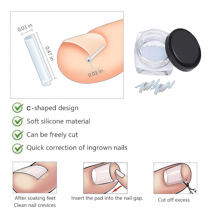 Professional ingrown toenail correction kit with travel storage box, pedicure tools, ingrown toenail patches, nail clippers, and nail file for convenient at-home foot care.