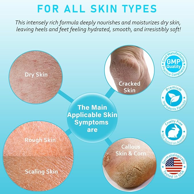 Urea Cream 40% Maximum Strength with Vitamin E & Salicylic Acid - Foot Cream for Winter Dry Cracked Heels - Intense Moisturizer for Hands, Feet & Body - Callus Remover - Lightweight Non-Greasy Formula