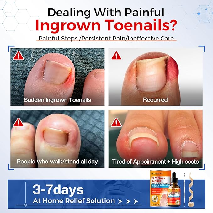 Ingrown Toenail Relief Kit: Professional 3-7 Day At-Home Ingrown Toenail Removal Drops With Ingrown Toenail Lifter & Self-Adhesive Bandage For Men Women, 30ml Softener For Hard Curved Nails