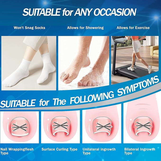 Ingrown Toenail Treatment with Upgraded 6-Angle Shape,Titanium Alloy Ingrown Toenail Corrector for Quick Relief,At-Home Ingrown Toenail Removal Kit for Toenail Curled Corrector,9Pcs