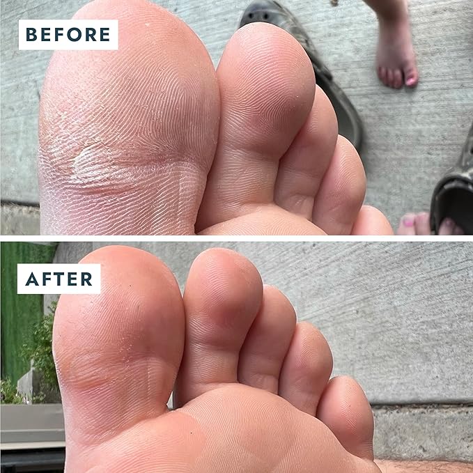 VOESH Solemate Heel Repair Balm, Heel Moisturizer & Repair, Balm for Rough and Cracked Heels, Foot Care