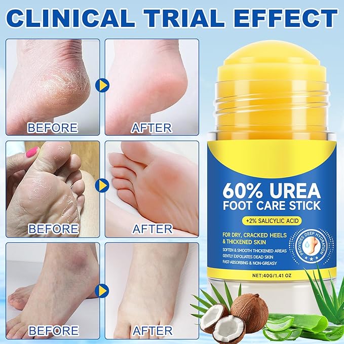60% Urea Foot Care Stick plus 2% Salicylic Acid, Foot Lotion Hydrates & Nourish, Provides Deep Hydration, Soften & Smooth Thickened Areas, Fast-Absorbing, for Women and Men