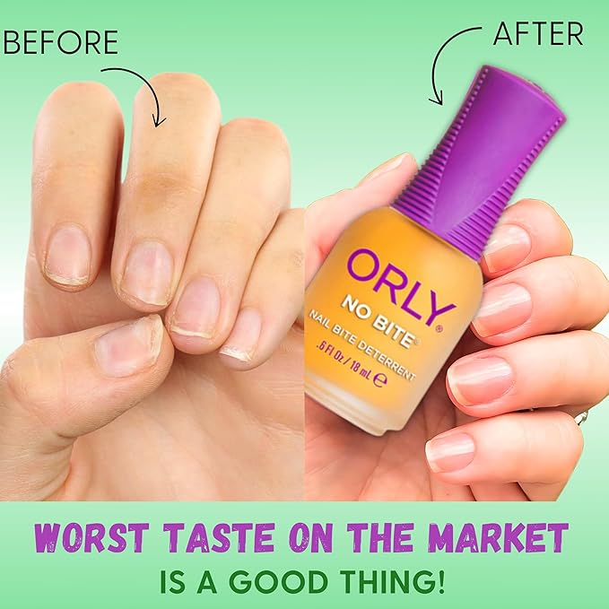 ORLY Nail Treatment No Bite | Nail Biting Deterrent & Bitter-Tasting Formula To Help Stop Adults And Children From Nail Biting | Vegan, Non-Toxic, Protects Manicured Nails (6Fl oz/18ml)