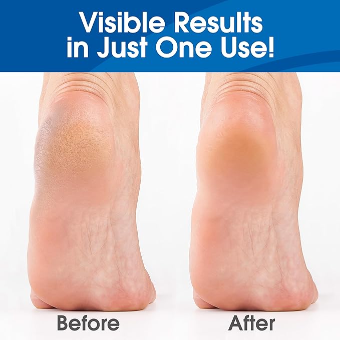 Callus Remover for Feet, Extra Strength Foot Callus Remover Gel, 8oz Salon Grade Home Pedicure Supplies for Dry Skin, Cracked Heel, Professional Strength Foot Care, Unscented