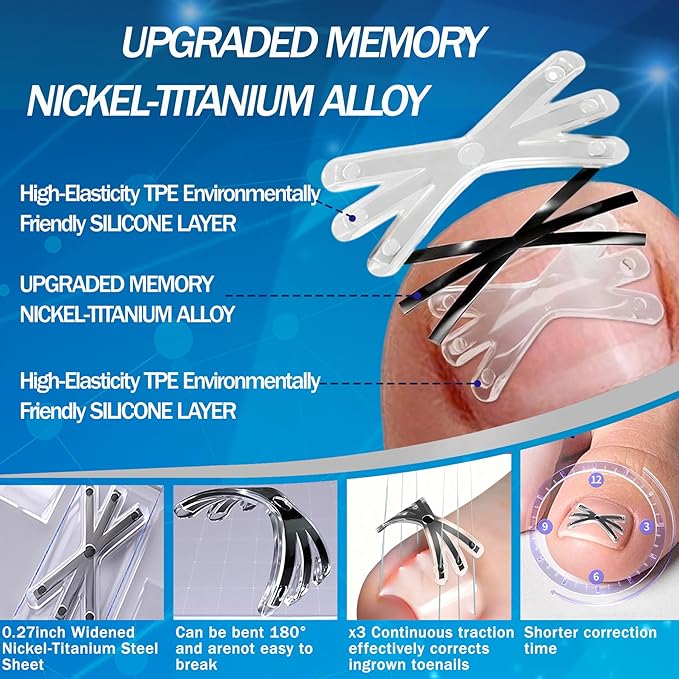 Ingrown Toenail Treatment with Upgraded 6-Angle Shape,Titanium Alloy Ingrown Toenail Corrector for Quick Relief,At-Home Ingrown Toenail Removal Kit for Toenail Curled Corrector,9Pcs