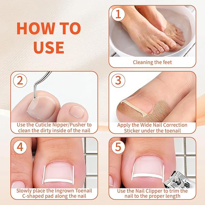 Ingrown Toenail Removal Kit, Ingrown Toenail Tool Kit Corrector with Ingrown Toenail Correction Strips, Toe Separators, Painless File and Lifter for Home Pedicure Care