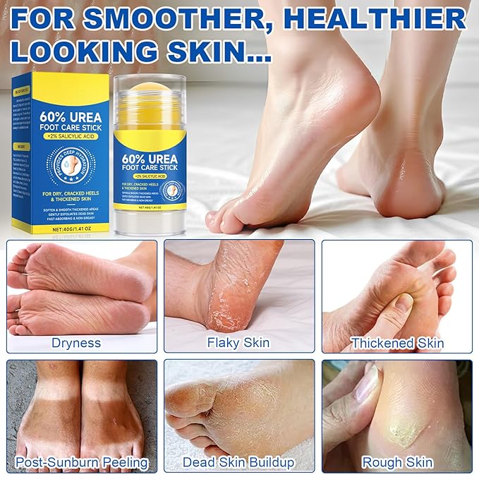 60% Urea Foot Cream Stick with 2% Salicylic Acid,Foot Care Cream Moisturizer for Dry Cracked Feet, Knees, Elbows, Hands,Moisturizes and Hydrates the Dry Skin,Callus Remover&Soften Dead Skin (2)