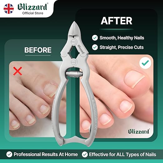 Toenail Clippers by Blizzard – Medical Grade Double Action Toe Nail Nipper Cutter for Thick Nails Seniors – 6 inch German Tool Barrel Spring