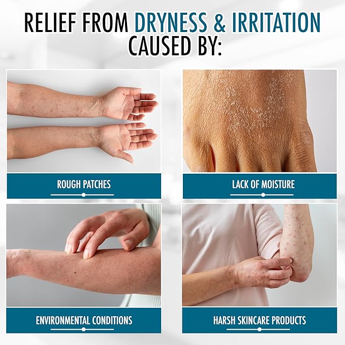 GLY MIRACLE Lightly Scented Non-Greasy Body Lotion, 12 oz High-Glycerin Hydration for Extremely Dry Skin, Hands, Feet & Body