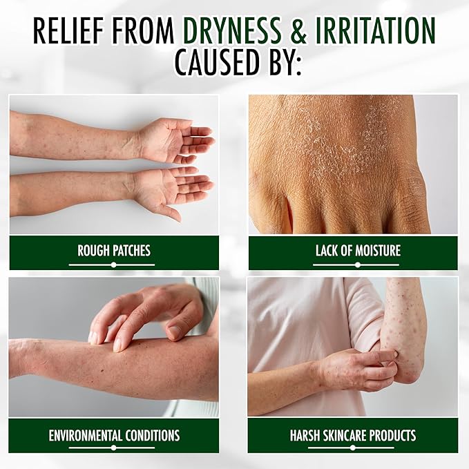GLY MIRACLE Fragrance-Free Non-Greasy Body Lotion, 16 oz High-Glycerin Moisturizer for Sensitive, Extremely Dry Skin, Hands, Feet & Body