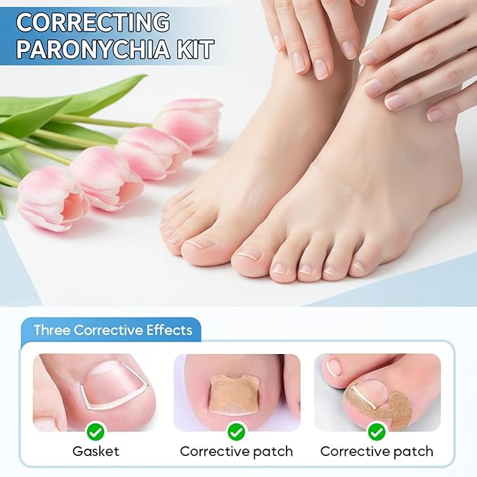 Ingrown Toenail Corrector Set, Professional Toenail Care Set with U-Shaped Breathable Strips, Curved Nail Correction Patch, Painless File & Lifter Tools, At-Home Foot Care for Men & Women.