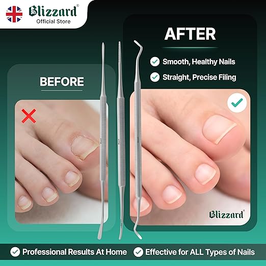 Ingrown Toenail File Set by Blizzard – 3 Piece Double-Ended Tool Kit with Blacks File, Nail Cleaner and Lifter for Cleaning and Care of Ingrown Toenails - Premium Stainless Steel