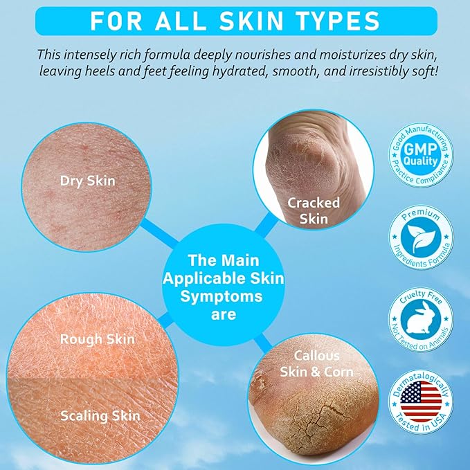 Urea 40% Foot Cream Maximum Strength - with Vitamin E & 2% Salicylic Acid - Deep Moisturizing for Winter Cracked Heels - Softens & Long Moisture for Rough Dead Skin on Hands, Feet, Elbows - Rich
