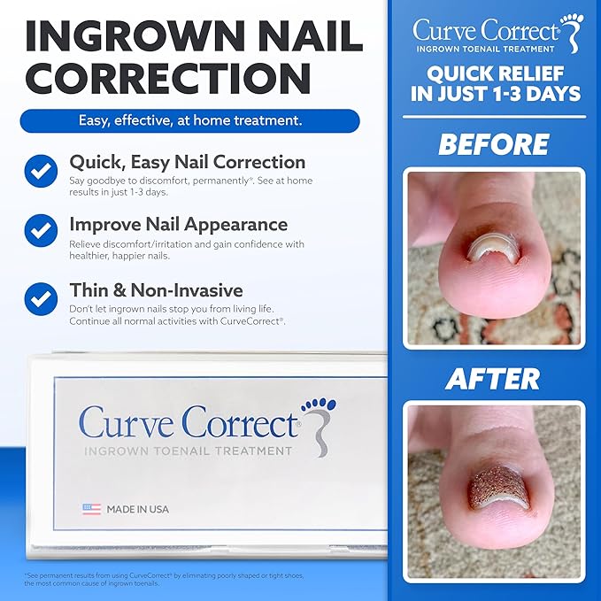 CurveCorrect® Ingrown Toenail Treatment Kit - Ingrown Toenail Corrector Kit with 10 Braces - at Home Ingrown Toenail Correction - Big Toe Ingrown Nail Removal