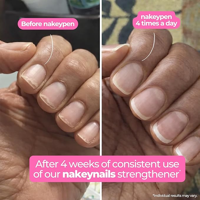 Nail Strengthener & Nail Hardener Serum | Fast-Absorbing Nail Care for Thin, Weak & Peeling Nails | Made with Niacinamide, Keratin, Peptide & Hyaluronic Acid | 45 day supply