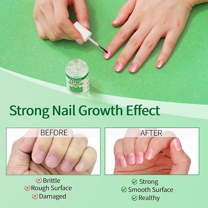 Nail Biting Treatment For Kids, Nail Biting Prevention, No Bite Nail Care, Thumb Sucking Deterrent For Ages 3+, 0.5 fl oz (10ml)