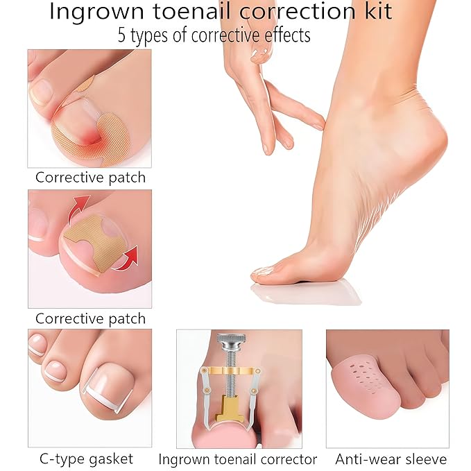 Professional ingrown toenail correction kit with travel storage box, pedicure tools, ingrown toenail patches, nail clippers, and nail file for convenient at-home foot care.